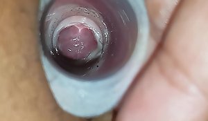 A close up become visible forwards wifes cervix