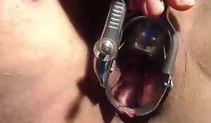 Speculum,show increased by touch my cervix close up